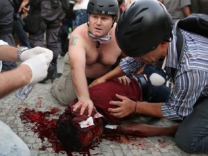 Cinegrafista foi atingido na cabeça por um rojão disparado por um manifestante