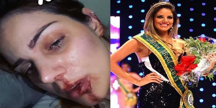 Renata Lustosa denuncia que sofre agressões do companheiro nas redes sociais