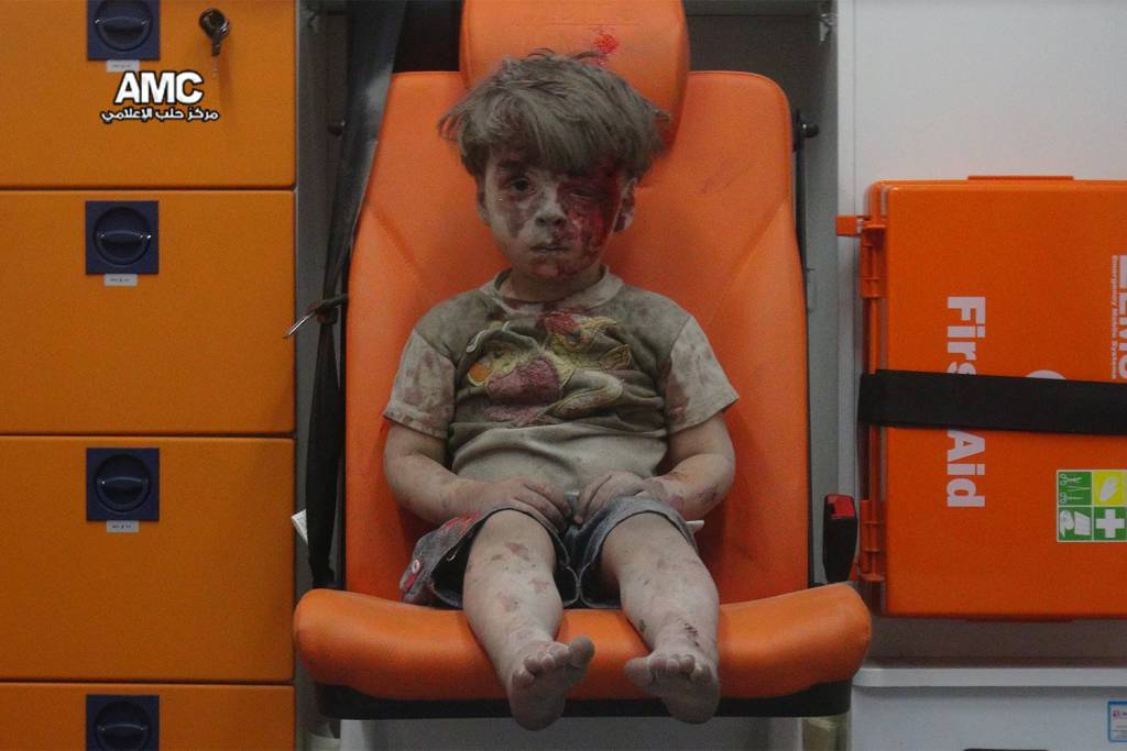 Foto de criança síria ferida em Aleppo