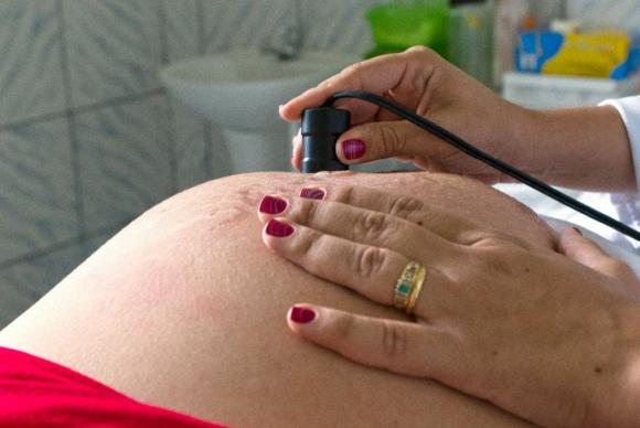 De acordo com o presidente da Sociedade de Pediatria de São Paulo, a ingestão de álcool na gravidez pode levar à Síndrome Alcoolica Fetal.