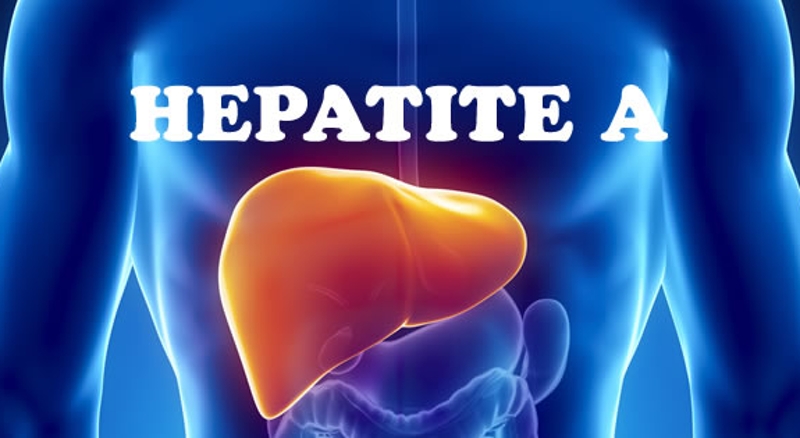 Hepatite A