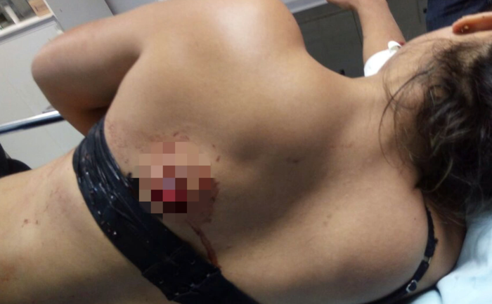 Maria do Socorro foi baleada nas costas pela PM