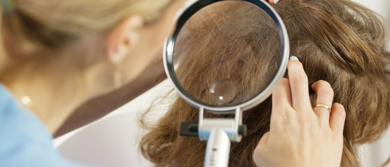 Exame dos fios de cabelo