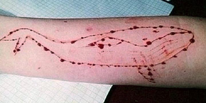 Baleia azul desenhada com estilete no braço de adolescente