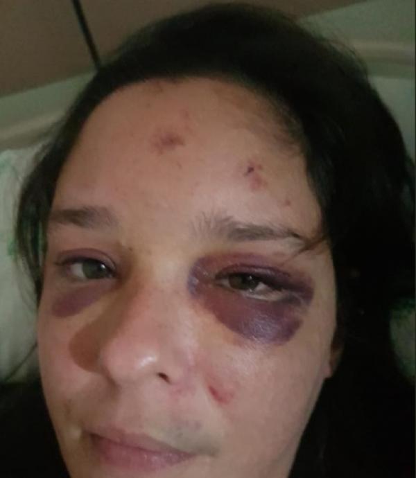 A servidora pública Paula Pinheiro Ramos Pessoa Guerra, 37, foi espancada em Recife
