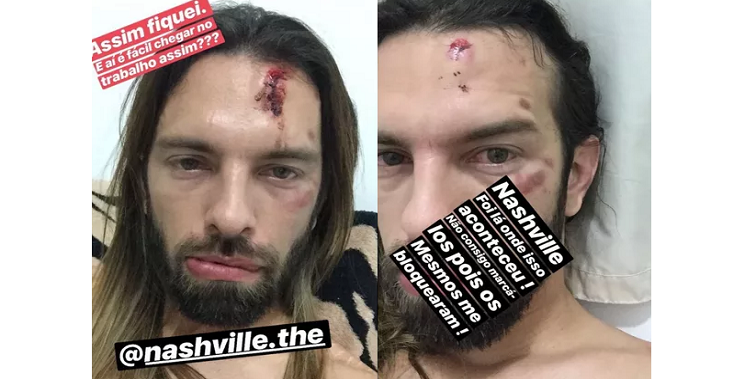 Felipe divulgou fotos ferido nas redes sociais