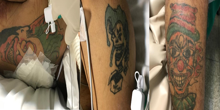 Tatuagens do paciente