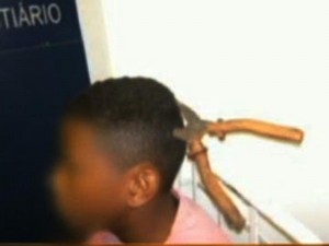 Um menino de 12 anos precisou passar por uma cirurgia depois de ser ferido por um alicate na parte de trás da cabeça. Ele deu entrada no Hospital de S