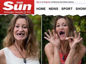 A ex-modelo Paula Hamilton, 51 anos, perdeu os dentes da frente em um acidente de carro