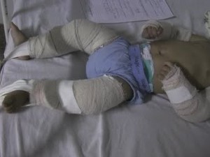 Criança foi vítima do padastro em Santa Catarina