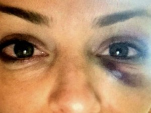 A noiva do suplente foi agredida, estupraeda e mantida em cárcere privado