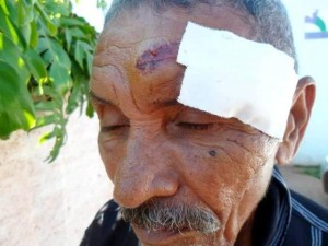 Lucas Gomes, de 80 anos, agredido pelo filho
