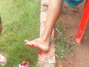 Banhistas mostra o pé mordido por uma piranha na barragem do Bezerro