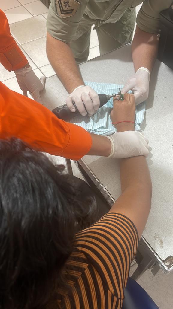Criança autista fica com o dedo preso em anel