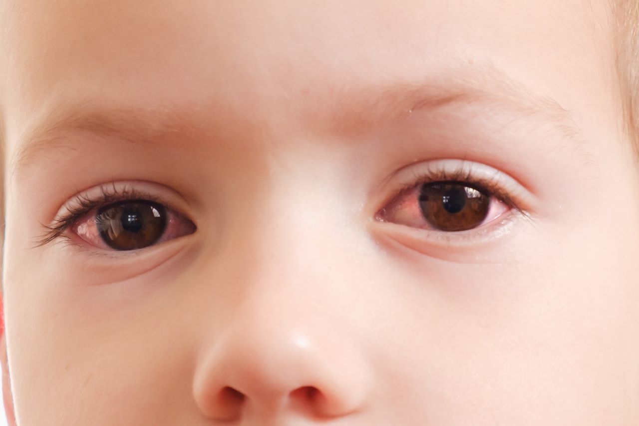 Doença nos olhos
