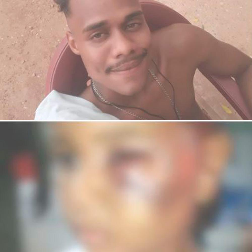 Suspeito teria agredido a criança com um soco no rosto