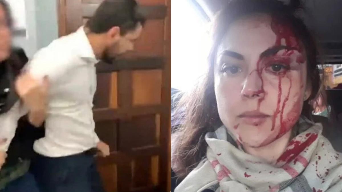 Gabriela Samadello foi agredida de forma brutal por Demétrius Oliveira
