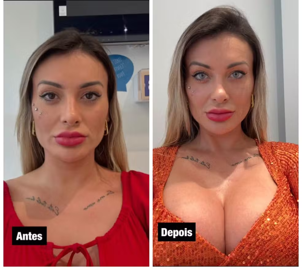 Antes e depois de Andressa Urach