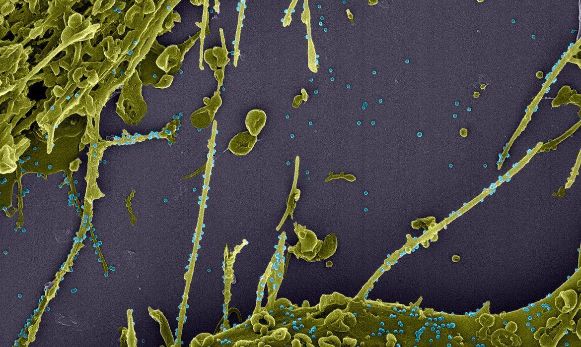 Coronavirus