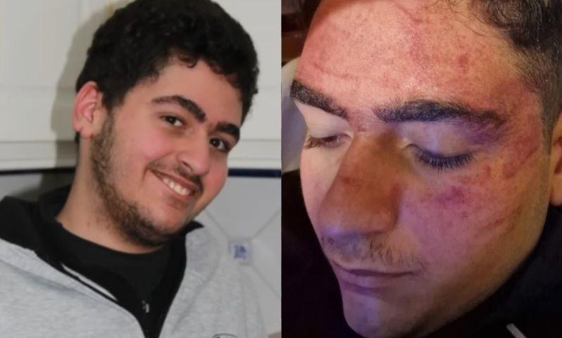 Murillo, 15 anos, é autista severo e não verbal família denuncia violência policial em Portugal