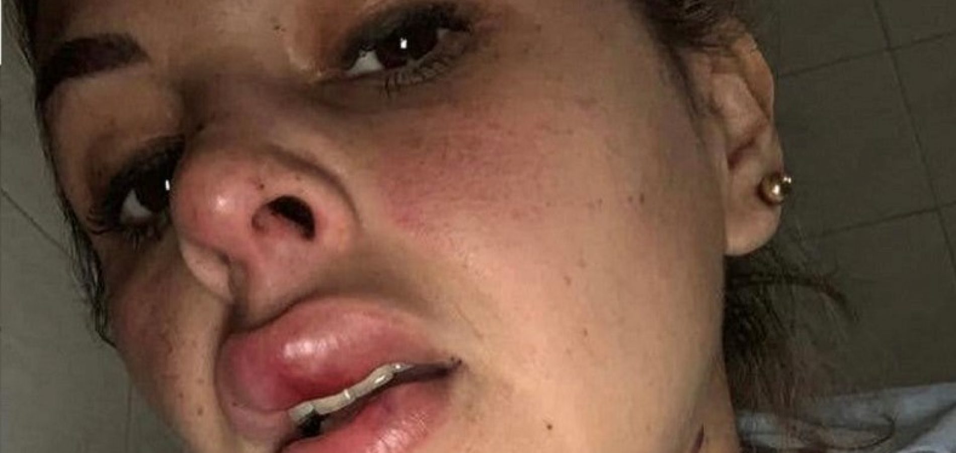 Esposa de jogador que atuou no Piauí usa internet para denunciar agressões