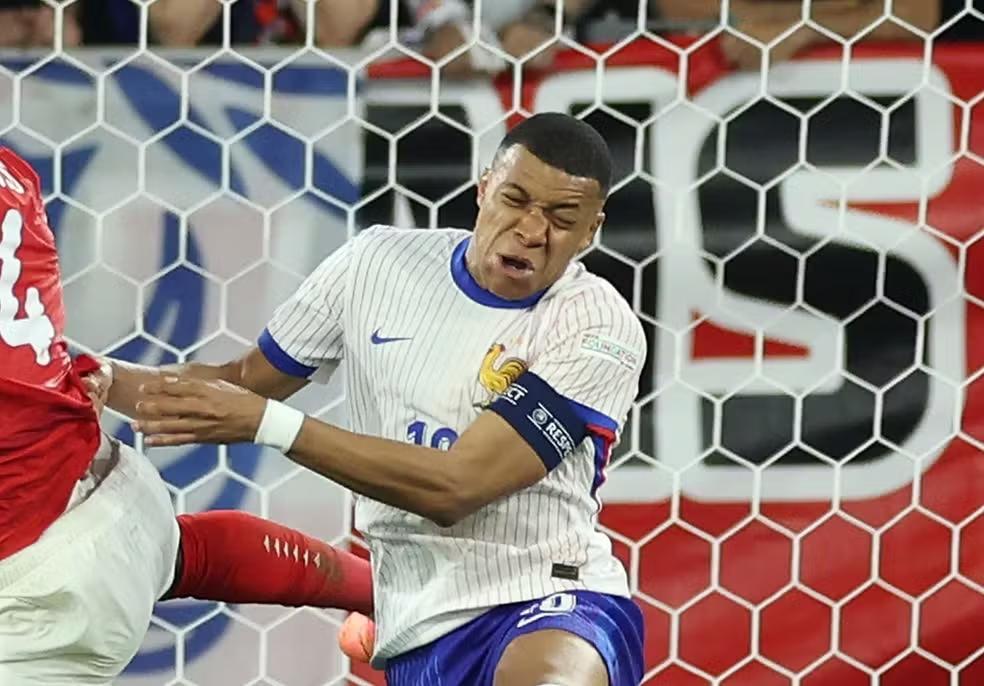 Mbappé quebrou o nariz ao dar uma cabeçada no ombro de Danso