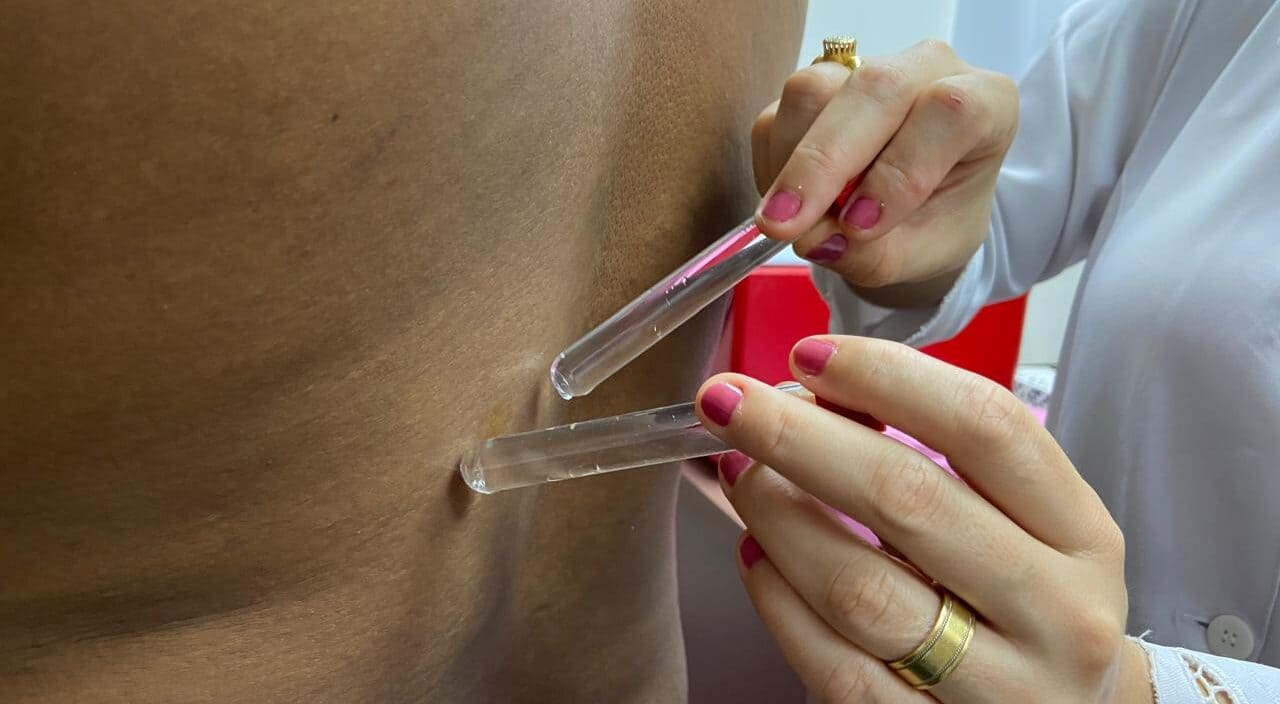 HPM vira referência estadual e intensifica combate à hanseníase com atendimento completo