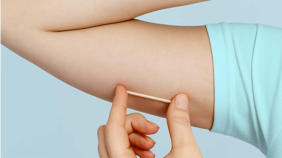 Implanon, contraceptivo será disponibilizado gratuitamente no mutirão da saúde da mulher