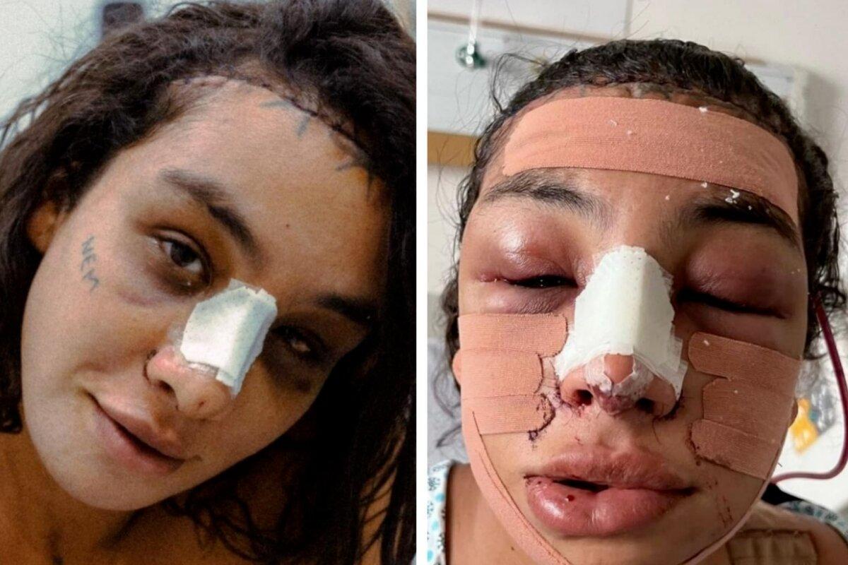 Linn da Quebrada aparece com rosto irreconhecível