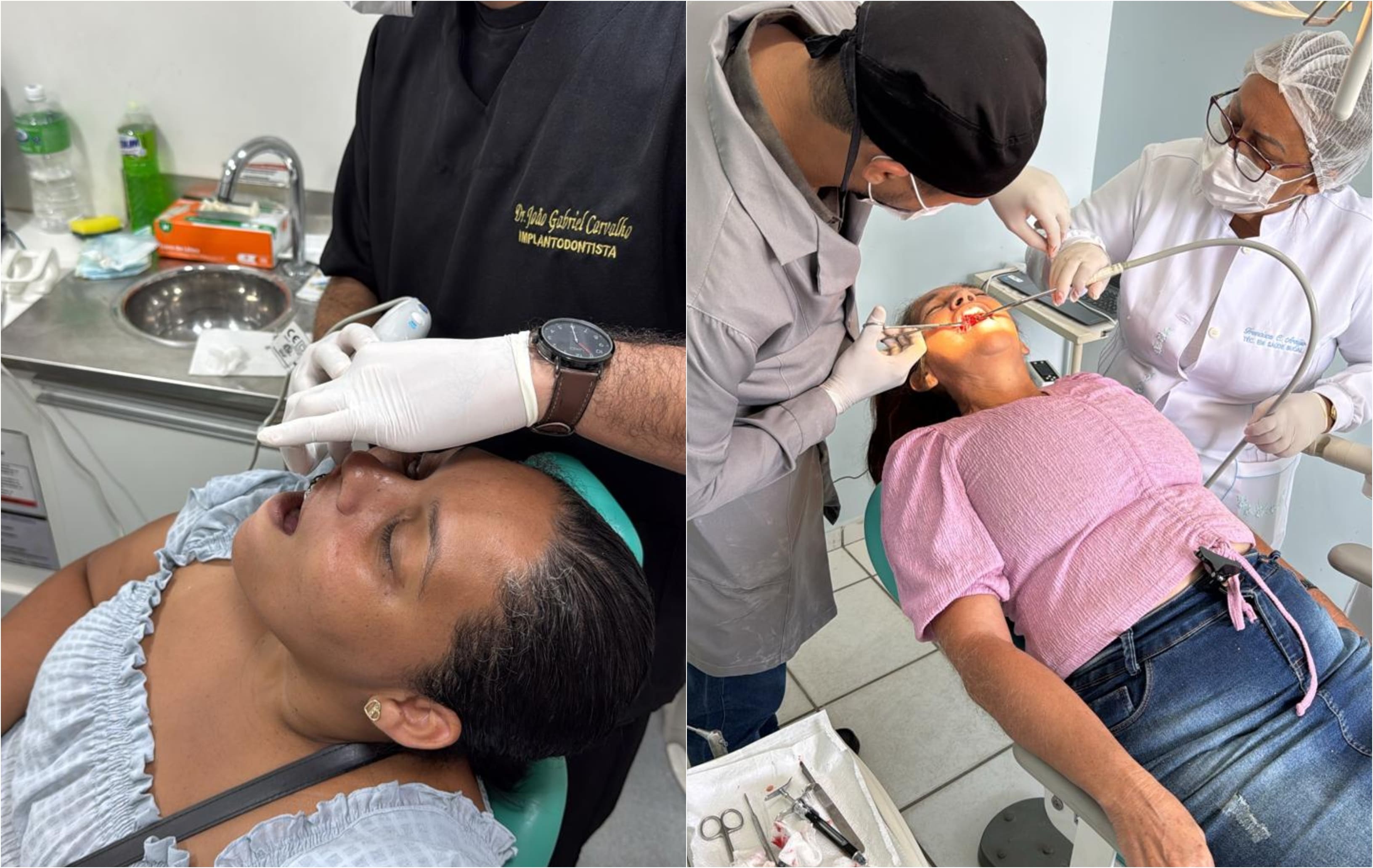 Pacientes recebem atendimentos para passar para fase de colocação do implante dentário