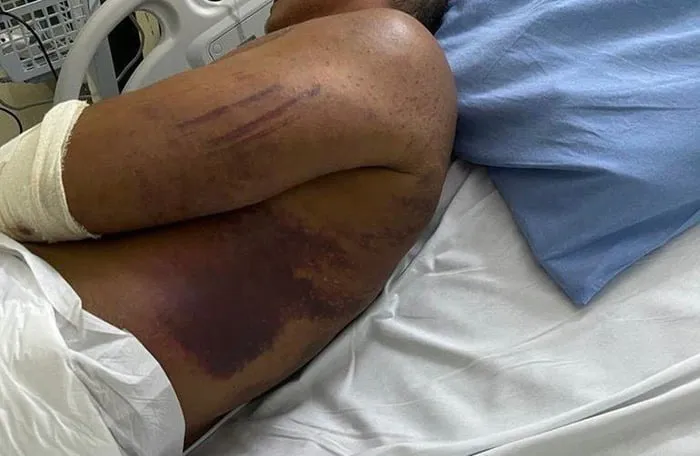 Major foi brutalmente torturado por policiais militares