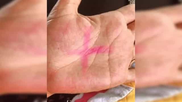 Vítima de violência pede ajuda com foto nas redes sociais