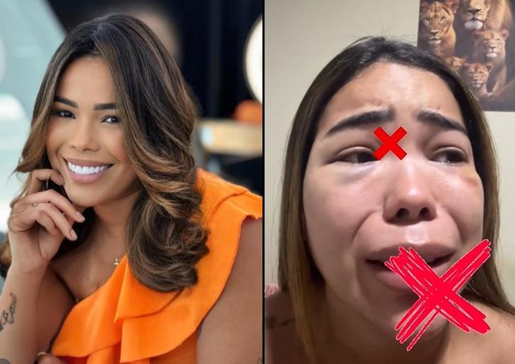Paulla Rafaela denunciou agressão do namorado nas redes sociais