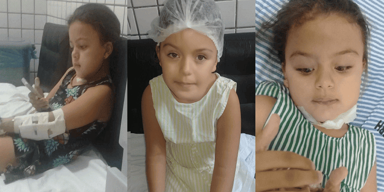 A cirurgia de Ana Clara foi de alta complexidade e foi um sucesso