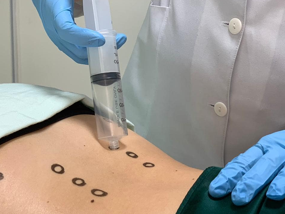 Ozonioterapia é eficaz no tratamento da Covid-19