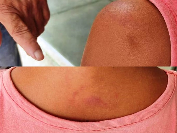Criança de 7 anos é agredida pela mãe