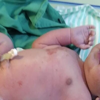 Bebê nasceu bem e saudável