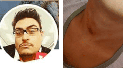 Rafão e  as marcas da agressão