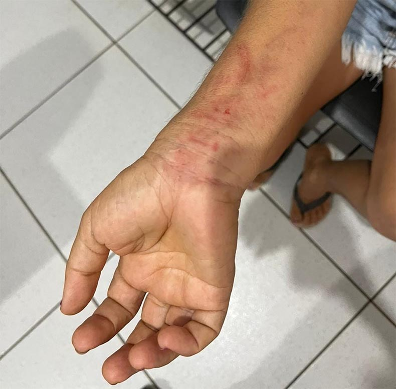 Mulher é mantida em cárcere privado por oito meses no Piauí