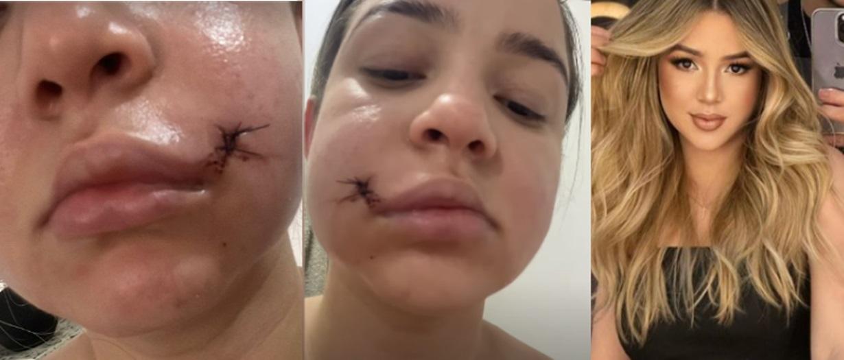 Rosto de Mariana antes e após as agressões