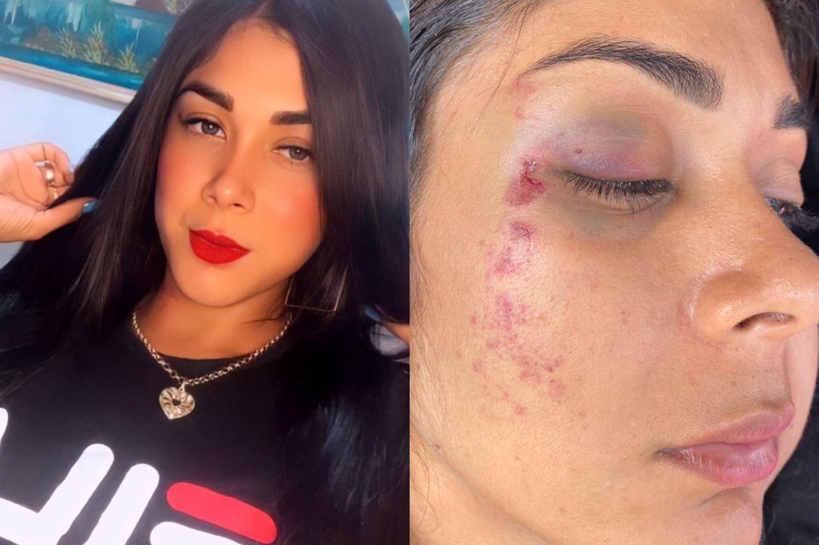 A vendedora teve o rosto bastante ferido