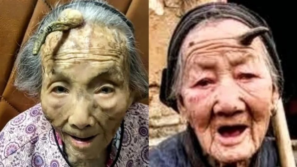 Chen e Zhang Ruifang, de 107 e 101 anos, respectivamente, com seus "chifres"