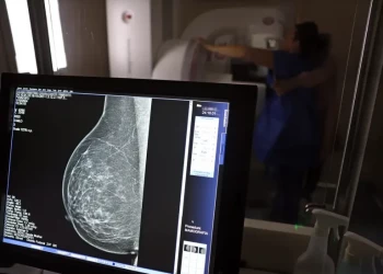 Produto brasileiro pode combater câncer de mama e redução dos efeitos da quimioterapia