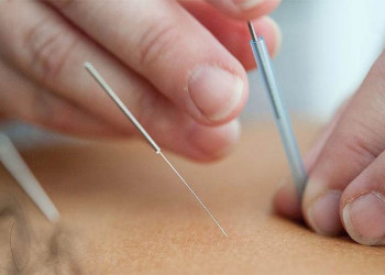 Governo do Brasil regulamenta o exercício profissional de acupuntura