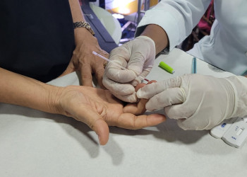 FMS alerta foliões para realização de teste de HIV após carnaval