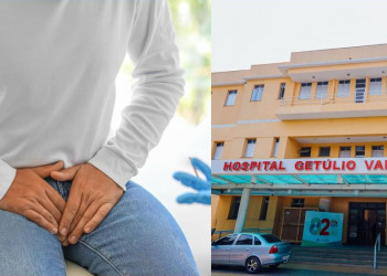 Hospital realiza mutirão de cirurgia contra câncer de pênis; Piauí tem alta nos casos