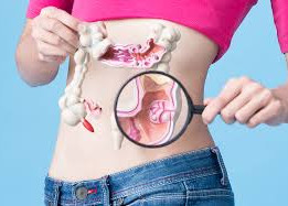 Especialistas discutem em Teresina o aumento de casos do câncer colorretal