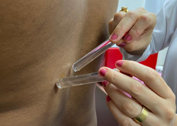 Hospital da PM se consolida como referência no tratamento da hanseníase