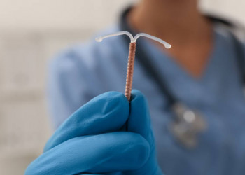 Parnaíba amplia acesso ao DIU gratuito e reforça o cuidado feminino
