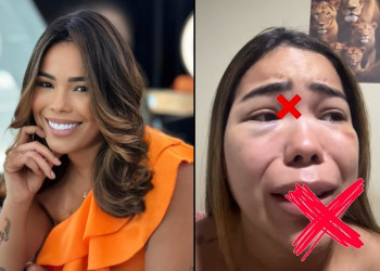 Blogueira de Teresina aparece com rosto machucado e denuncia agressões do namorado